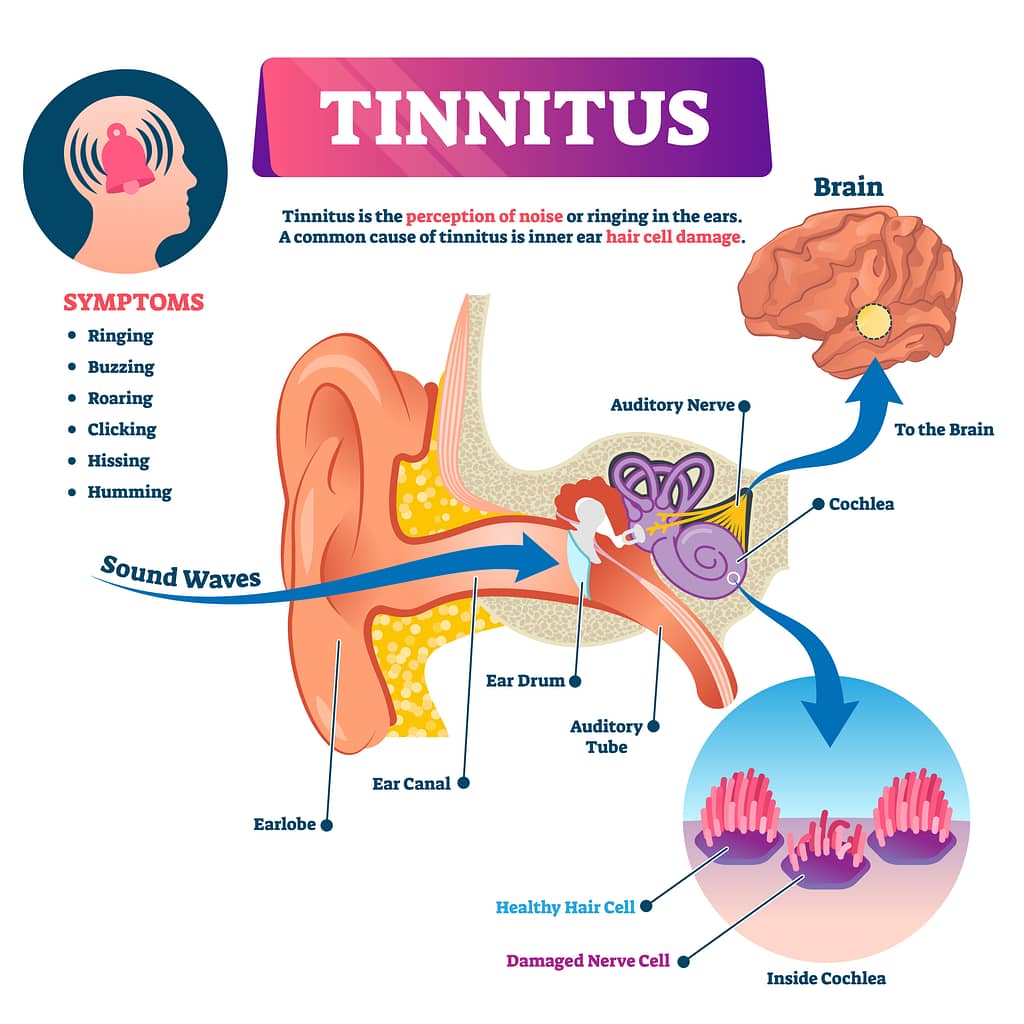 Tinnitus vector illustration