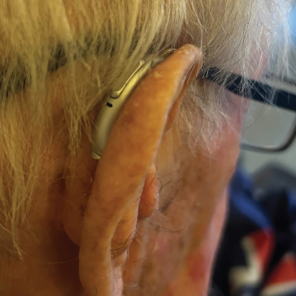 Mr. Dalton fitted with brand new hearing aid